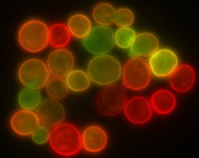 Abbildung 1: Ein mit konfokaler Mikroskopie aufgenommenes Bild von Protoplasten (links), das feiner fokussiert ist als ein Bild von Mikrokugeln ähnlicher Größe, das mit herkömmlicher Epifluoreszenzmikroskopie aufgenommen wurde.