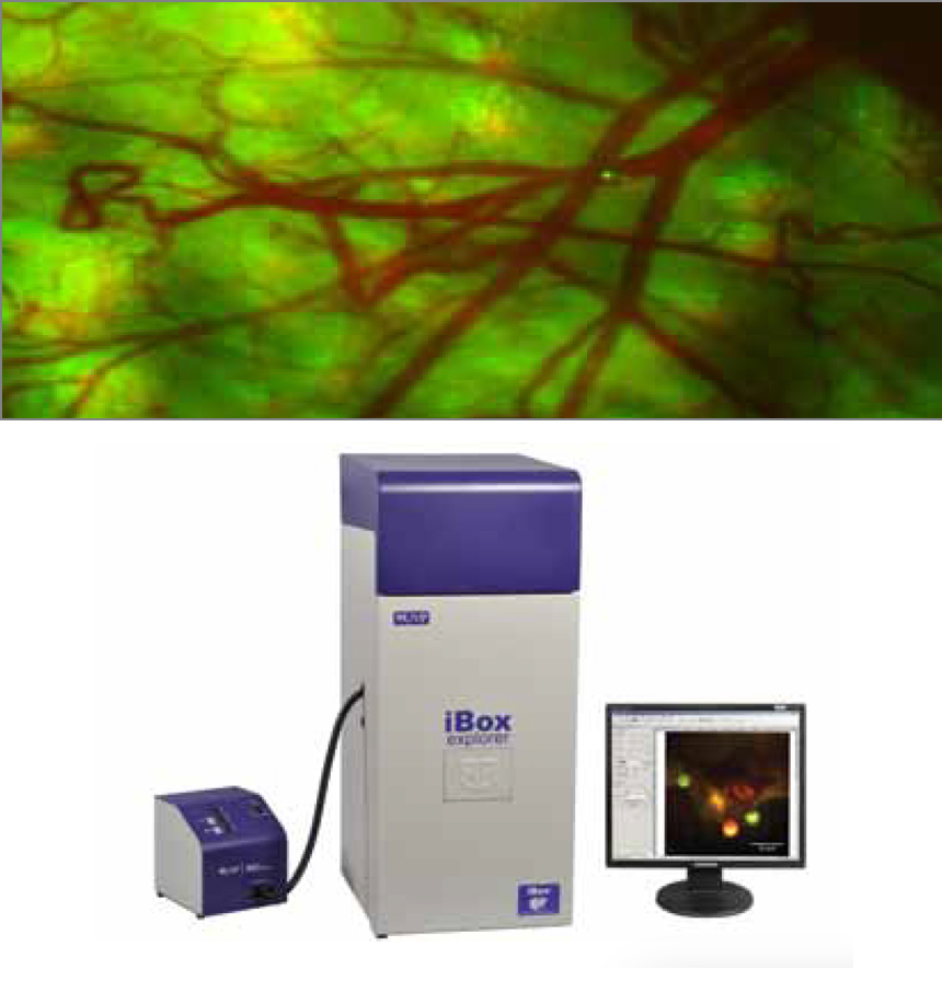 Cellular trafficking of cancer cells within the vasculature of a mouse, which was imaged using UVP’s iBox<sup>®</sup> Explorer™ In Vivo imager. The imager uses off-the- shelf achromatic lenses and other single lenses and filters to form multi-element objectives and tube lenses that can be mixed and matched to provide seven different magnifications. Filter combinations were optimized to ensure good signal-to-noise ratio for each color channel. GFP tagged nucleus of the Human HT-1080 fibrosarcoma cell can be seen migrating downstream from the injection site, passing the bifurcation of a distal vein (down and to the right of center).
